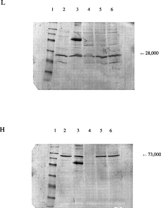 Fig. 3. Panel L is stained for the regulatory subunit (γ-GCSl), which has a molecular weight of 28,000 (arrow). Panel H is stained for the catalytic subunit (γ-GCSh), which has a molecular weight of 73,000 (arrow). The first lane is a molecular weight marker: 175,000, 83,000, 62,000, 47,500, 32,500, 25,000, 16,500, and 6,500, respectively, from the top. Lanes 2 and 3, hemolysate from a normal subject; lane 4, hemolysate from the patient; lanes 5 and 6, hemolysates from the mother and brother of the patient, respectively. A nonspecific band observed on the third lane of both sheets may represent an aggregation product formed during preparation of the samples.