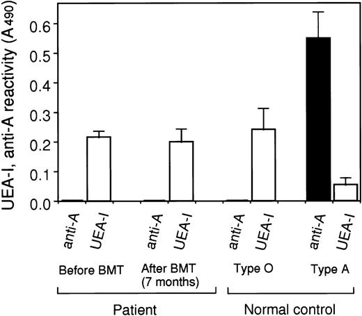 Fig. 2. Blood group antigens on plasma vWF after ABO major mismatched BMT. The reactivities of the recipient’s plasma vWF before and after (7 months) major mismatched BMT (patient S.Y. with type O and the donor with type A) against UEA-I (white) and anti-A MoAb (black) were measured using ELISA and normalized as the reactivity (A490) of 6 U/dL (1 μg/mL) of vWF solution. The reactivities of plasma vWF from normal subjects with blood group O and A against UEA-I and anti-A antibody were also measured as a control. Data express the means ± SE (n = 3) for a patient and the means ± SD (n = 6) for a control.