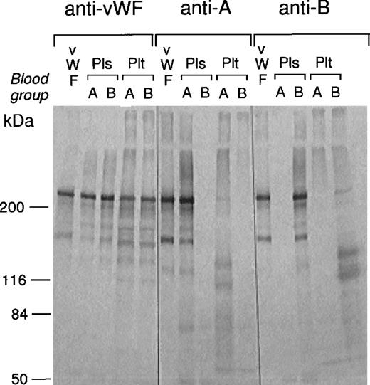 Fig. 3. Blood group antigens on vWF from plasma and platelets. vWF was immunoprecipitated from plasma (Pls) and the platelets (Plt) extracts from normal subjects with blood groups A and B. Aliquots of each immunoprecipitates and the standard vWF (vWF, 0.5 μg) were solubilized in SDS-buffer and subjected to SDS-PAGE under reducing conditions. Proteins were transferred to a PVDF membrane followed by immunoblotting with anti-vWF antibody, anti-A and B MoAbs. vWF showed the subunit band at about 270 kD. Blood group antigens were detected on the vWF band including minor degraded band at about 140 kD prepared from plasma and the purified vWF. vWF from platelets showed no or a very faint reactivity against blood group antibody, but platelets contained smaller bands at about 110 and 130 kD that weakly reacted with anti-blood group antibodies but not with anti-vWF antibody. Numbers on the left indicate the positions of molecular mass standard (kDa). The same results were obtained when using the other two platelet specimens from blood groups A and B.