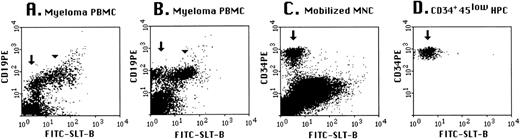 Fig. 5. SLT-1 receptors are present on a B-cell subset of myeloma patients and absent on HPC. Cells from peripheral blood of myeloma patients (A and B) were stained with anti-CD19-PE and FITC-SLT-B. Mobilized blood mononuclear cells (C) were stained with anti-CD34-PE/anti-CD45-QR and FITC-SLT-B and files were gated for the HPC subset (D), as described in Materials and Methods. For (C) and (D), the arrows indicate the HPC subset. For myeloma, the peripheral blood includes both polyclonal and monoclonal B cells.24 The arrowhead indicates the monoclonal subset of B cells and the arrow highlights the polyclonal subset, presumptively normal B cells that lack SLT-1 receptors.