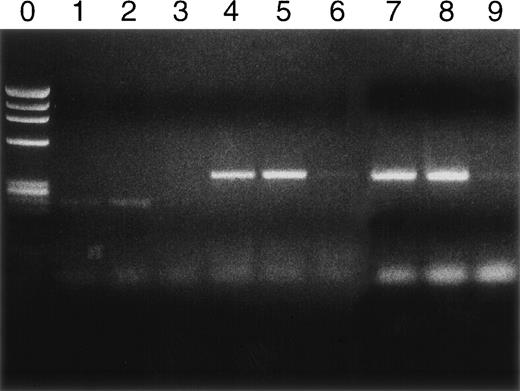 Fig. 3. Cytokine RNA levels by PCR. Rows 1, 2, and 3 are IFN-γ; rows 4, 5, and 6 are TNF-; and rows 7, 8, and 9 are IL-10. Naive controls never inoculated with TMEV are rows 3, 6, and 9. TMEV diseased but untransplanted animals are rows 1, 4, and 7. Mice with TMEV treated by transplantation are rows 2, 5, and 8. Assays were performed on day 128.