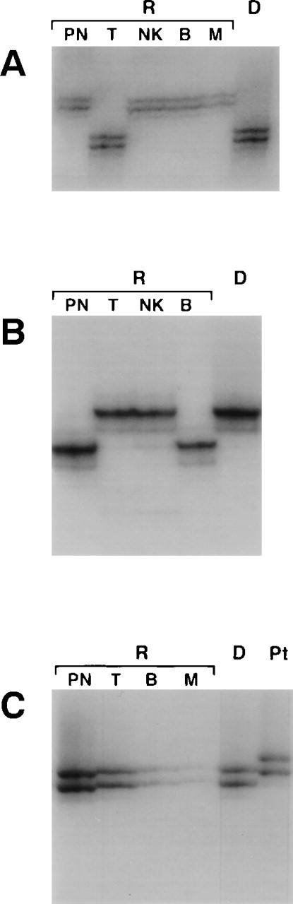 Fig. 1. Leukocyte chimerism of B+ SCID patients after BMT. Microsatellite typing of polymorphonuclear cells (PN), T lymphocytes (T), natural killer cells (NK), B lymphocytes (B), and monocytes (M) from recipients (R) or from donor cells (D) was performed at the D10S206 (A), DXS101 (B), or HPRT (C) loci, depending on how informative the locus was for each subject. (A) UPN 299; (B) UPN 272b; (C) UPN 223.