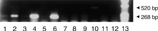 Fig. 3. Expression of Cre in EIIa-cre transgenic mice by RT-PCR. Lanes 1-6, cDNA amplified with control primer pairSacII/293. Lanes 7-12, cDNA amplified with primer pair cre1/cre2. Lanes 2, 4, 6, 8, 10, 12 amplified in the presence of RT. Lanes 1, 3, 5, 7, 9, 11 controls amplified without RT. Lanes 1, 2, 7, 8 RNA isolated from leg muscle. Lanes 3, 4, 9, 10 RNA isolated from ovaries. Lanes 5, 6, 11, 12 RNA isolated from bone marrow. Lane 13 molecular marker. Note that primer pair cre1/cre2 amplifies a band of 520 bp and control primer pair SacII/293 amplifies a band of 268 bp.