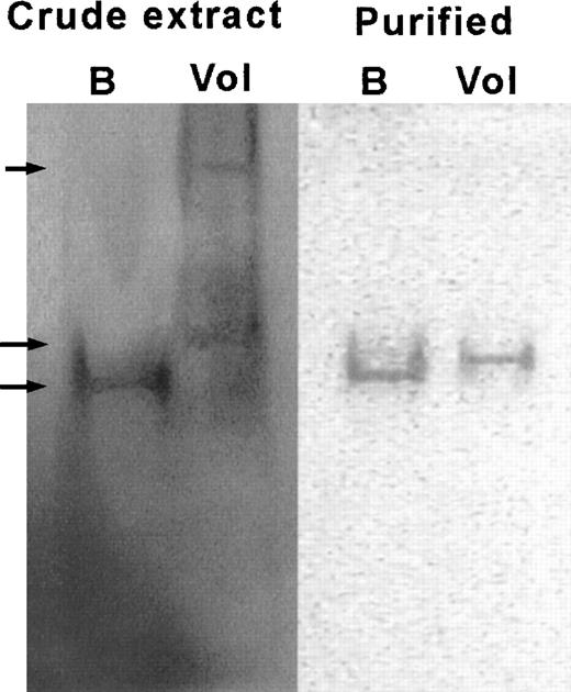 Fig. 6. Electrophoretic mobility of rG6PD B and rG6PD Volendam. rG6PD B and rG6PD Volendam were electrophoresed in native 5% polyacrylamide gel. The gels were stained for G6PD activity by PMS and MTT, as described.15 Left: Bacterial crude extract of E coli DR612 containing pMPM-A4 encoding human G6PD B (B) or G6PD Volendam (Vol). From top to bottom, arrows indicate the 70%, 95%, and 100% mobilities. Right: rG6PD B and rG6PD Volendam purified by affinity chromatography.