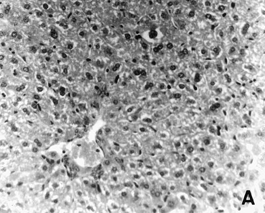 Fig. 6. Histology of BMT mice. (A through D) The histology of C57BL/6 mice transplanted with B10.A(4R) BM. One group of mice was injected with allo-restricted CTL while the control group did not receive CTL. (A) Liver from a CTL-treated mouse 3 weeks posttransplant, with no significant inflammation or necrosis. (B) Liver from a control mouse 3 weeks posttransplant, with mild periportal inflammation. Skin from a CTL-treated mouse (C) and a control mouse (D) 3 weeks posttransplant, with no significant inflammation or keratinocyte necrosis. Tissues were also examined at 4, 5, and 6 weeks posttransplant and showed no evidence of GVHD in either CTL-treated or control mice (not shown). (E-H) show the histology of (C57BL/6 × BALB/c) F1 mice, transplanted with BM from littermates. One group of mice was injected with allo-restricted CTL and a control group did not receive CTL. (E) Liver from a CTL-treated mouse 4 weeks posttransplant, with no significant inflammation or necrosis. (F) Liver from control mouse 4 weeks posttransplant, with no significant inflammation and necrosis. Skin from a CTL-treated mouse (G) and a control mouse (H) 4 weeks posttransplant, with no significant inflammation or keratinocyte necrosis. Tissues were also examined at 3 and 5 weeks posttransplant and showed no evidence of GVHD in either CTL-treated or control mice (not shown). (All H&E-stained sections, original magnification × 20.) Sections from colon and stomach also showed no significant inflammation (not shown).