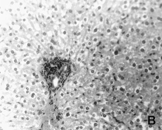 Fig. 6. Histology of BMT mice. (A through D) The histology of C57BL/6 mice transplanted with B10.A(4R) BM. One group of mice was injected with allo-restricted CTL while the control group did not receive CTL. (A) Liver from a CTL-treated mouse 3 weeks posttransplant, with no significant inflammation or necrosis. (B) Liver from a control mouse 3 weeks posttransplant, with mild periportal inflammation. Skin from a CTL-treated mouse (C) and a control mouse (D) 3 weeks posttransplant, with no significant inflammation or keratinocyte necrosis. Tissues were also examined at 4, 5, and 6 weeks posttransplant and showed no evidence of GVHD in either CTL-treated or control mice (not shown). (E-H) show the histology of (C57BL/6 × BALB/c) F1 mice, transplanted with BM from littermates. One group of mice was injected with allo-restricted CTL and a control group did not receive CTL. (E) Liver from a CTL-treated mouse 4 weeks posttransplant, with no significant inflammation or necrosis. (F) Liver from control mouse 4 weeks posttransplant, with no significant inflammation and necrosis. Skin from a CTL-treated mouse (G) and a control mouse (H) 4 weeks posttransplant, with no significant inflammation or keratinocyte necrosis. Tissues were also examined at 3 and 5 weeks posttransplant and showed no evidence of GVHD in either CTL-treated or control mice (not shown). (All H&E-stained sections, original magnification × 20.) Sections from colon and stomach also showed no significant inflammation (not shown).