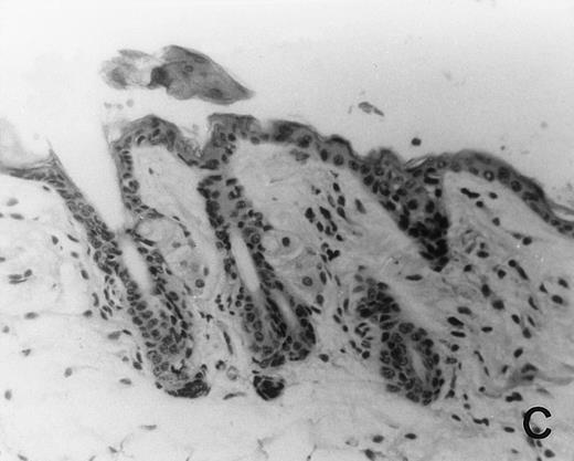 Fig. 6. Histology of BMT mice. (A through D) The histology of C57BL/6 mice transplanted with B10.A(4R) BM. One group of mice was injected with allo-restricted CTL while the control group did not receive CTL. (A) Liver from a CTL-treated mouse 3 weeks posttransplant, with no significant inflammation or necrosis. (B) Liver from a control mouse 3 weeks posttransplant, with mild periportal inflammation. Skin from a CTL-treated mouse (C) and a control mouse (D) 3 weeks posttransplant, with no significant inflammation or keratinocyte necrosis. Tissues were also examined at 4, 5, and 6 weeks posttransplant and showed no evidence of GVHD in either CTL-treated or control mice (not shown). (E-H) show the histology of (C57BL/6 × BALB/c) F1 mice, transplanted with BM from littermates. One group of mice was injected with allo-restricted CTL and a control group did not receive CTL. (E) Liver from a CTL-treated mouse 4 weeks posttransplant, with no significant inflammation or necrosis. (F) Liver from control mouse 4 weeks posttransplant, with no significant inflammation and necrosis. Skin from a CTL-treated mouse (G) and a control mouse (H) 4 weeks posttransplant, with no significant inflammation or keratinocyte necrosis. Tissues were also examined at 3 and 5 weeks posttransplant and showed no evidence of GVHD in either CTL-treated or control mice (not shown). (All H&E-stained sections, original magnification × 20.) Sections from colon and stomach also showed no significant inflammation (not shown).