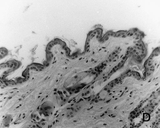 Fig. 6. Histology of BMT mice. (A through D) The histology of C57BL/6 mice transplanted with B10.A(4R) BM. One group of mice was injected with allo-restricted CTL while the control group did not receive CTL. (A) Liver from a CTL-treated mouse 3 weeks posttransplant, with no significant inflammation or necrosis. (B) Liver from a control mouse 3 weeks posttransplant, with mild periportal inflammation. Skin from a CTL-treated mouse (C) and a control mouse (D) 3 weeks posttransplant, with no significant inflammation or keratinocyte necrosis. Tissues were also examined at 4, 5, and 6 weeks posttransplant and showed no evidence of GVHD in either CTL-treated or control mice (not shown). (E-H) show the histology of (C57BL/6 × BALB/c) F1 mice, transplanted with BM from littermates. One group of mice was injected with allo-restricted CTL and a control group did not receive CTL. (E) Liver from a CTL-treated mouse 4 weeks posttransplant, with no significant inflammation or necrosis. (F) Liver from control mouse 4 weeks posttransplant, with no significant inflammation and necrosis. Skin from a CTL-treated mouse (G) and a control mouse (H) 4 weeks posttransplant, with no significant inflammation or keratinocyte necrosis. Tissues were also examined at 3 and 5 weeks posttransplant and showed no evidence of GVHD in either CTL-treated or control mice (not shown). (All H&E-stained sections, original magnification × 20.) Sections from colon and stomach also showed no significant inflammation (not shown).