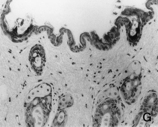 Fig. 6. Histology of BMT mice. (A through D) The histology of C57BL/6 mice transplanted with B10.A(4R) BM. One group of mice was injected with allo-restricted CTL while the control group did not receive CTL. (A) Liver from a CTL-treated mouse 3 weeks posttransplant, with no significant inflammation or necrosis. (B) Liver from a control mouse 3 weeks posttransplant, with mild periportal inflammation. Skin from a CTL-treated mouse (C) and a control mouse (D) 3 weeks posttransplant, with no significant inflammation or keratinocyte necrosis. Tissues were also examined at 4, 5, and 6 weeks posttransplant and showed no evidence of GVHD in either CTL-treated or control mice (not shown). (E-H) show the histology of (C57BL/6 × BALB/c) F1 mice, transplanted with BM from littermates. One group of mice was injected with allo-restricted CTL and a control group did not receive CTL. (E) Liver from a CTL-treated mouse 4 weeks posttransplant, with no significant inflammation or necrosis. (F) Liver from control mouse 4 weeks posttransplant, with no significant inflammation and necrosis. Skin from a CTL-treated mouse (G) and a control mouse (H) 4 weeks posttransplant, with no significant inflammation or keratinocyte necrosis. Tissues were also examined at 3 and 5 weeks posttransplant and showed no evidence of GVHD in either CTL-treated or control mice (not shown). (All H&E-stained sections, original magnification × 20.) Sections from colon and stomach also showed no significant inflammation (not shown).