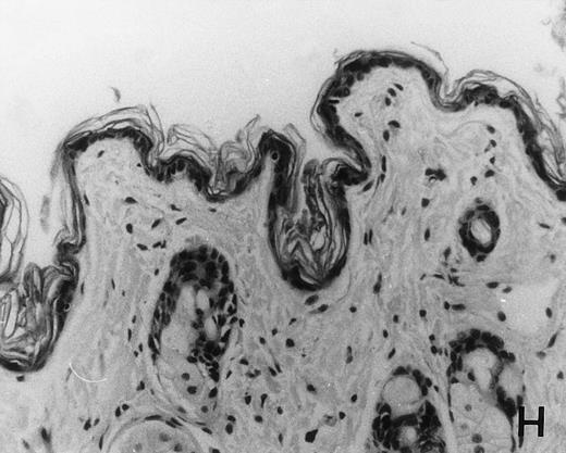 Fig. 6. Histology of BMT mice. (A through D) The histology of C57BL/6 mice transplanted with B10.A(4R) BM. One group of mice was injected with allo-restricted CTL while the control group did not receive CTL. (A) Liver from a CTL-treated mouse 3 weeks posttransplant, with no significant inflammation or necrosis. (B) Liver from a control mouse 3 weeks posttransplant, with mild periportal inflammation. Skin from a CTL-treated mouse (C) and a control mouse (D) 3 weeks posttransplant, with no significant inflammation or keratinocyte necrosis. Tissues were also examined at 4, 5, and 6 weeks posttransplant and showed no evidence of GVHD in either CTL-treated or control mice (not shown). (E-H) show the histology of (C57BL/6 × BALB/c) F1 mice, transplanted with BM from littermates. One group of mice was injected with allo-restricted CTL and a control group did not receive CTL. (E) Liver from a CTL-treated mouse 4 weeks posttransplant, with no significant inflammation or necrosis. (F) Liver from control mouse 4 weeks posttransplant, with no significant inflammation and necrosis. Skin from a CTL-treated mouse (G) and a control mouse (H) 4 weeks posttransplant, with no significant inflammation or keratinocyte necrosis. Tissues were also examined at 3 and 5 weeks posttransplant and showed no evidence of GVHD in either CTL-treated or control mice (not shown). (All H&E-stained sections, original magnification × 20.) Sections from colon and stomach also showed no significant inflammation (not shown).