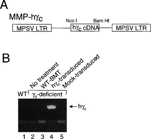 Fig. 2. pMMP-driven expression of γc expressed in peripheral blood of mice that received bone marrow transplantation of human γc-transduced γc-deficient bone marrow. (A) Schematic of pMMP-γc. (B) Human γc was detected by PCR of genomic DNA from peripheral blood cells from γc-deficient mice that received γc-deficient bone marrow transduced with human γc, but not from wild-type mice or γc-deficient mice that received no treatment, bone marrow from a wild-type mouse, or bone marrow from a mock-transduced γc-deficient mouse.
