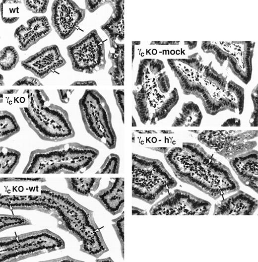 Fig. 4. Reconstitution of IEL in γc-deficient mice that received γc-transduced bone marrow. Paraffin sections of small intestinal tissue were stained with hematoxylin and eosin and evaluated for the presence of IEL by light microscopy (40×). wt, wild-type mouse; γcKO, γc-deficient mouse that received no treatment; γcKO-mock, γc-deficient mouse that received mock-transduced γc-deficient bone marrow; γcKO-wt, γc-deficient mouse that received wild-type bone marrow; γcKO-hγc, γc-deficient mouse that received γc-deficient bone marrow transduced with human γc. Sections shown are representative of results from 2 separate experiments. Arrows indicate IEL in the wt, γcKO-wt, and γcKO-hγc mice.