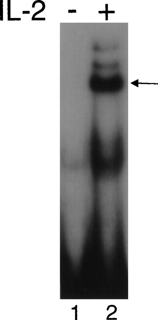 Fig. 8. γc-transduced mice exhibited IL-2–induced STAT DNA binding activity. Whole-cell extracts were prepared from splenocytes that were cultured without or with 2 nmol/L IL-2 for 15 minutes, and EMSAs were performed using the β-casein probe.
