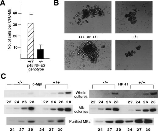 Fig. 2. Reduced number of cells per CFU-Mk in the absence of NF-E2 function. (A) Quantification of mean number of cells per CFU-Mk based on counting cells from 100 colonies derived from control (+/+ or +/−, designated as +/?, N = 10) and mutant (−/−, N = 5) fetal livers. Statistical significance was established using the Student’s t-test, P = .003. (B) Bright-field photomicrographs of representative individual megakaryocyte colonies at day 7 from control (left) and mutant (right) fetal livers (original magnification × 200). (C) RT-PCR analysis for c-Mpl (left) and control (hypoxanthine phosphoribosyl transferase, HPRT, right) mRNA levels in wild-type (+/+) and NF-E2–deficient (−/−) megakaryocytes. Numbers refer to PCR cycles.