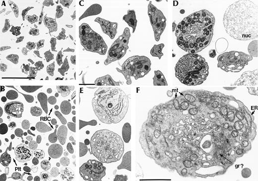 Fig. 3. Ultrastructural analysis of particles found in the plasma of p45 NF-E2–deficient adult mice. (A and B) Low-power images of cells in the platelet-rich plasma fraction, showing normal appearance of platelets in control samples (A) but a predominance of RBC fragments (RBC) and fewer, bizarre platelet forms (Plt) in mutant samples (B); bar = 5 μm. (C through E) Higher magnification images of platelets and platelet-like fragments, comparing the normal platelet appearance in controls (C) with large, round, heterogeneous and abnormally organized fragments in p45 NF-E2 knockout mice (D and E). nuc, naked nucleus; bar = 1 μm. (F) High-power view of a representative NF-E2–deficient platelet-like particle, revealing disorganized and abnormal contents, including excess mitochondria (mt) and endoplasmic reticulum (ER), a dense tubular system, and possibly rare abnormal granules (gr?); bar = 1 μm.
