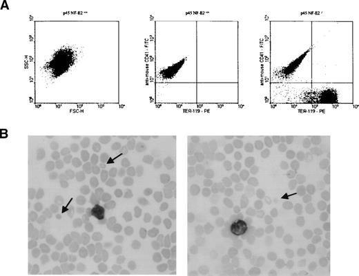 Fig. 5. Simultaneous flow cytometric analysis of RBCs and platelets in the washed platelet-rich plasma of p45 NF-E2−/− mice, showing substantial contamination of platelet-sized cells by RBC fragments. (A) Left panel: Forward (FSC-H) and side (SSC-H) scatter characteristics of the platelet population in wild-type mice. In the analysis of wild-type mice (center panel), only platelets (CD41-positive cells) were observed using the scatter characteristics shown in (A). In samples from p45 NF-E2 knockout mice (right panel), a subtantial population of RBC fragments (TER-119–positive) was present, comprising 56% of total events in this analysis of platelet-sized particles. Results were identical in 2 independent experiments. (B) Representative blood smears from adult p45 NF-E2 knockout mice, showing the presence of small RBC fragments (arrows) and absence of blood platelets.