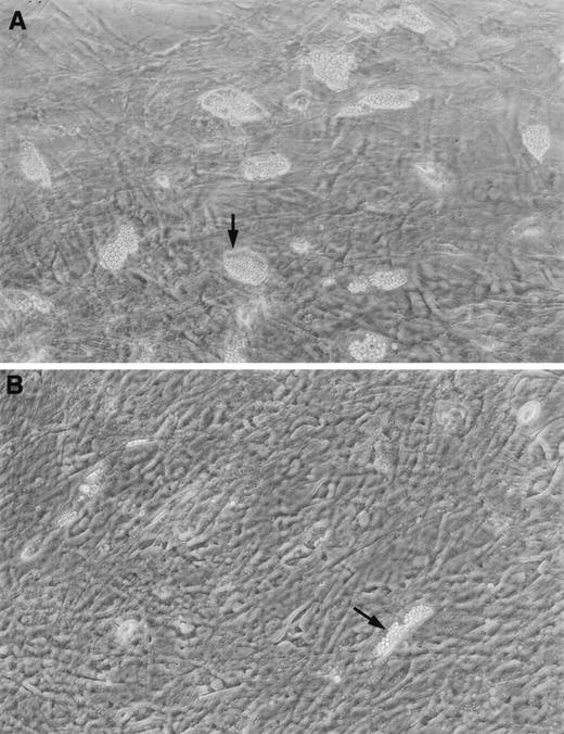 Fig. 2. Stromal layers from long-term cultures of (A) a normal control showing an abundance of clusters, and (B) a patient with SD, showing the characteristic paucity of fat cell clusters.