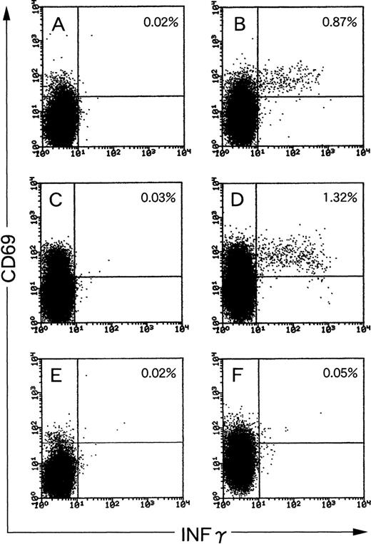 Fig. 1. EBV-specific IFNγ-producing CD8+ T cells in PBMCs of EBV-seropositive (A through D) and EBV-seronegative (E and F) individuals. PBMCs were stimulated with autologous LCLs (B, D, and F) at a responder stimulator ratio of 1. After fixation and permeabilization, the cells were stained for CD8, CD69, and IFNγ. CD8+ cells were gated and analyzed by flow cytometry. Unstimulated PBMCs were also incubated, fixed, and then mixed with autologous LCLs before staining (A, C, and E). The frequency of CD8+/CD69high T cells that produced IFNγ is shown as a percentage of the total number of CD8 cells.