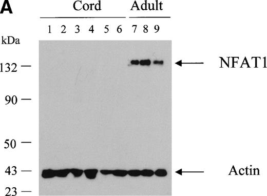 Fig. 1. Undetectable NFAT1 protein expression in unstimulated UCB T cells. (A) T cells were purified from fresh MNC of 6 UCB units (lanes 1 through 6) and from 3 adult PBMC (lanes 7 through 9). Protein extracts equivalent to 3 × 105 T cells were loaded per lane and analyzed by Western blotting with a combination of anti-NFAT1 and anti–β-actin antibodies. (B) T cells were further separated into CD45RA+ and CD45RO+ expressing cells and protein extracts analyzed as above.