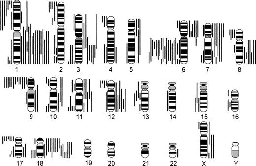 Fig. 5. Chromosomal imbalances in cb lymphomas (n = 68). Each bar indicates the gain (right side) or loss (left side) of the respective chromosomal region in 1 lymphoma case.