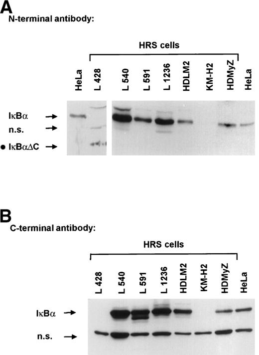 Fig. 2. Western blot analysis of IκB proteins in HD-derived cell lines. Whole-cell extracts were analyzed using specific antibodies against the N-terminus (A) and the C-terminus (B) of IκB. Specific protein bands are indicated by an arrow and the truncated form in L428 cells (IκB▵C) is marked with a dot.