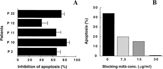 Fig. 2. (A) Fas/FasL interaction mediated cytotoxicity. Jurkat cell apoptosis by leukemic cells from P2, P10, P11, P12, P22 at an E/T ratio of 10:1 was inhibited by the antagonist Fas:Fc. Results are expressed as the percentage inhibition of apoptosis induced by leukemic cells in the presence of the blocking MoAb. Leukemic cells were incubated with 15 μg/mL Fas:Fc for 30 minutes and than used as effector cells in the JAM test. The experiment was repeated 3 times with each patient. (B) Effect of Fas-Fc concentration on apoptosis. Results are expressed as the percentage of Jurkat apoptosis induced by leukemic cells from patient P2, in the presence or absence of the blocking MoAb and shows 1 representative experiment out of 2.