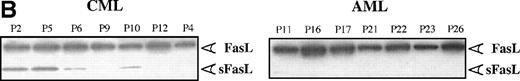 Fig. 3. (A) FasL concentrations in AML and CML patients. FasL was quantified by Western blotting assay by using a National Institutes of Health Image Program 1.6. Data for patients were normalized to the PBMC from 2 normal individuals, for which the data have been included at each time. (B) FasL profile. Western blot showing FasL in cells from leukemic patients. Cells were lysed in lysis buffer, separated on a 4/20% polyacrylamide gel, the protein transferred to a nitrocellulose membrane, and the membrane was probed with an anti-FasL MoAb. Fourteen patients were analyzed for FasL contained by Western blot. All the samples tested contained FasL and several also contained the truncated form of the protein. FasL (37 kD) and short FasL (sFasL, 26 kD) are indicated by arrows. Short FasL was never detected in samples from AML or normal donors.