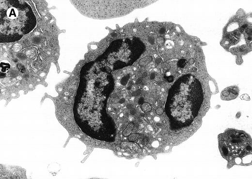 Fig. 1. Electron micrograph of a peripheral blood neutrophil from a C/EBPɛ−/−mouse (A and B) and a wild-type mouse (C). (A) The C/EBPɛ−/− peripheral blood neutrophil shows signs of immaturity; the absolute number of granules is reduced and tertiary, bacilliform-shaped granules are missing. (B) Higher magnification of middle section of C/EBPɛ−/− neutrophil: The ratio of the larger, primary (electron-dense) granules (arrows) to the smaller less electron-dense, secondary granules is increased. In the less mature C/EBPɛ−/− neutrophils, most secondary granules appear electron-lucent, most likely due to extraction by glutaraldehyde fixation (arrowheads) as previously described.46 (C) For comparison, mature wild-type granulocyte has multiple, small secondary granules (arrows) and bacilliform tertiary granules (arrowhead).
