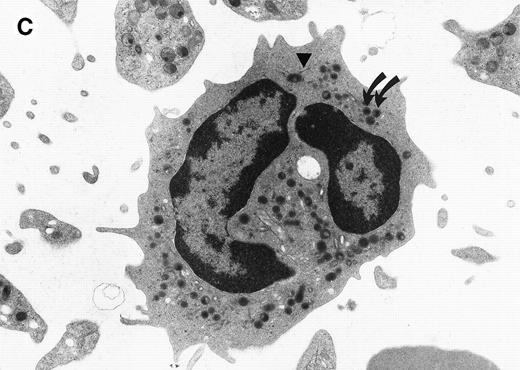 Fig. 1. Electron micrograph of a peripheral blood neutrophil from a C/EBPɛ−/−mouse (A and B) and a wild-type mouse (C). (A) The C/EBPɛ−/− peripheral blood neutrophil shows signs of immaturity; the absolute number of granules is reduced and tertiary, bacilliform-shaped granules are missing. (B) Higher magnification of middle section of C/EBPɛ−/− neutrophil: The ratio of the larger, primary (electron-dense) granules (arrows) to the smaller less electron-dense, secondary granules is increased. In the less mature C/EBPɛ−/− neutrophils, most secondary granules appear electron-lucent, most likely due to extraction by glutaraldehyde fixation (arrowheads) as previously described.46 (C) For comparison, mature wild-type granulocyte has multiple, small secondary granules (arrows) and bacilliform tertiary granules (arrowhead).