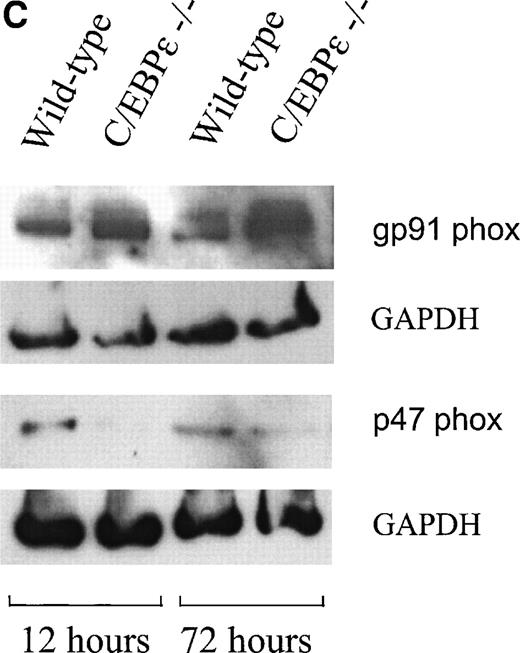 Fig. 2. (A, right) Northern blot analysis of gp91 phox expression from C/EBPɛ−/− and wild-type bone marrow cells. RNA from NIH 3T3 fibroblasts was used as negative control. Gp91 phox expression was not reduced in C/EBPɛ−/− bone marrow cells. Hybridization with a beta actin probe was used as a control for equal loading of samples. (A, left) RT-PCR assays to determine expression of the p22 phox, p40 phox, p47 phox, p67 phox and (B) rac-1 and -2 genes. Primers for GAPDH were used to test the integrity of the cDNAs. All genes were expressed in both wild-type and C/EBPɛ−/− bone marrow cells. (C) Western blot comparing the protein expression of gp91 phox and p47 phox in wild-type and C/EBPɛ−/− phagocytes collected at either 12 or 72 hours after intraperitoneal injection of 4% thioglycollate into the peritoneal cavity of wild type and C/EBPɛ−/− mice. The mean percentage of granulocytes and monocytes in the samples were at 12 hours: Wild-type, 70/30; C/EBPɛ−/−, 56/44 and at 72 hours: Wild-type, 75/25; C/EBPɛ−/−, 6/94. GAPDH expression was a control for equal loading. The reduction of p47 phox expression was found in 3 independent experiments. The figure depicts the results of a representative experiment.