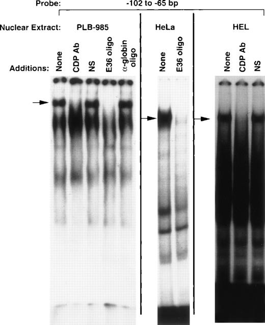 Fig. 1. CDP binds to the −102 to −65 bp region of the gp91phox promoter. EMSA was performed as described in Materials and Methods, with the −102 to −65 bp region of the gp9phox promoter as a probe and nuclear extract isolated from the indicated cell lines. Antiserum directed against CDP, normal guinea pig serum, or 20 ng of double-stranded oligonucleotide competitor was added to the binding reactions where indicated. The E36 oligonucleotide18 is a high affinity CDP-binding site, whereas the -globin oligonucleotide20 contains a CCAAT-box motif from that gene’s promoter and serves as a heterologous competitor. Arrows indicate CDP complexes. Relative DNA/protein complex mobilities cannot be directly compared between different cell lines.