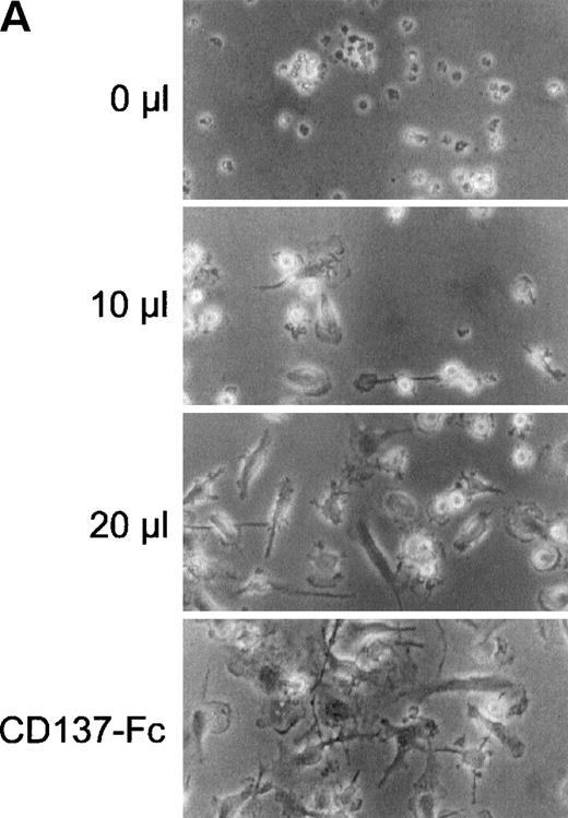 Fig. 6. CD137 induces proliferation of monocytes via autocrine induction of soluble factor(s). 105 peripheral monocytes were cultured on immobilized Fc or CD137-Fc protein for 24 hours. 0, 10, 20, or 30 μL of conditioned supernatant of these cultures were transferred to 100 μL of new cultures with untreated monocytes. (A) After 8 days, the cells were photographed at a magnification of 300×. The bottom panel depicts monocytes grown on immobilized CD137-Fc protein for the 8 days. (B) Proliferation of the cultures from (A) was determined at day 8 by a 24-hour pulse with 0.5 μCi3H-thymidine. () Proliferation of monocytes on immobilized CD137-Fc protein. Cultures supplemented with conditioned supernatant from CD137-Fc–activated monocytes proliferated significantly stronger; P < .007. This experiment was repeated 3 times with similar results.