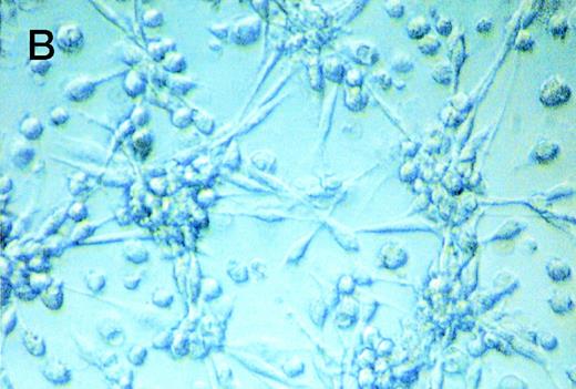 Fig. 2. CD137 induces proliferation of peripheral monocytes. (A) 105 monocytes were cultured on 96-well plates coated with Fc or CD137-Fc protein. Proliferation was determined daily by a 24-hour pulse with 0.5 μCi 3H-thymidine and differed significantly from day 3 onward, with P < .02. (B) Colonies/aggregates formed on CD137-treated monocytes. Photographs were taken at day 10 of culture at a magnification of 200×.