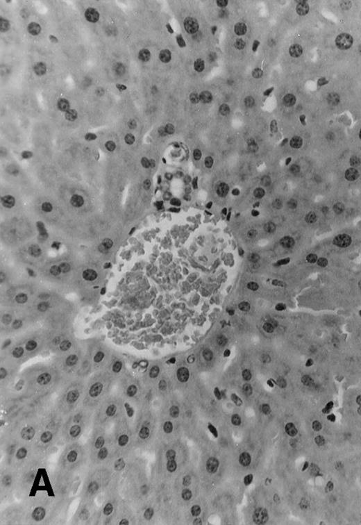 Fig. 4. Histology sections of liver from recipients of MHC mismatched TCD BM and allogeneic splenocytes. Sections of liver from (C57.BL6 × SJL) F1 mice that were transplanted on day 0 with 1 × 106 SJL TCD BM cells alone (A) or TCD BM in combination with 30 × 106 irradiated (7.5 Gy) splenocytes from SJL donors (B) or with 30 × 106 nonirradiated splenocytes (C). Mice were euthanized at day +51 and samples of liver tissue were fixed in 10% formalin, embedded in paraffin, and sections were stained with hematoxylin and eosin. Original magnification is ×165 in all 3 photomicrographs.