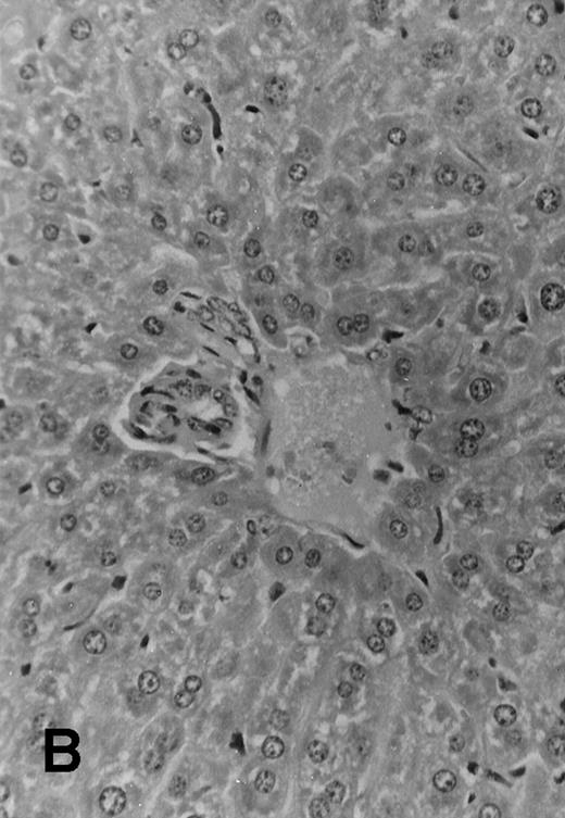 Fig. 4. Histology sections of liver from recipients of MHC mismatched TCD BM and allogeneic splenocytes. Sections of liver from (C57.BL6 × SJL) F1 mice that were transplanted on day 0 with 1 × 106 SJL TCD BM cells alone (A) or TCD BM in combination with 30 × 106 irradiated (7.5 Gy) splenocytes from SJL donors (B) or with 30 × 106 nonirradiated splenocytes (C). Mice were euthanized at day +51 and samples of liver tissue were fixed in 10% formalin, embedded in paraffin, and sections were stained with hematoxylin and eosin. Original magnification is ×165 in all 3 photomicrographs.