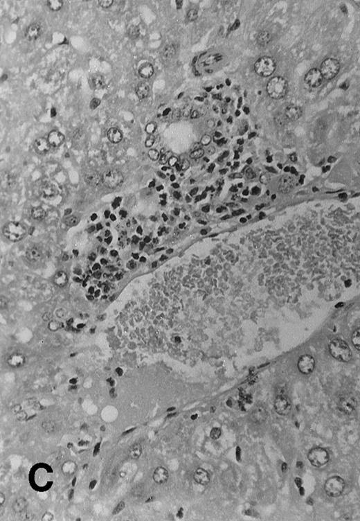 Fig. 4. Histology sections of liver from recipients of MHC mismatched TCD BM and allogeneic splenocytes. Sections of liver from (C57.BL6 × SJL) F1 mice that were transplanted on day 0 with 1 × 106 SJL TCD BM cells alone (A) or TCD BM in combination with 30 × 106 irradiated (7.5 Gy) splenocytes from SJL donors (B) or with 30 × 106 nonirradiated splenocytes (C). Mice were euthanized at day +51 and samples of liver tissue were fixed in 10% formalin, embedded in paraffin, and sections were stained with hematoxylin and eosin. Original magnification is ×165 in all 3 photomicrographs.