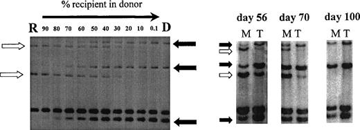 Fig. 2. Chimerism analysis of patient no. 7 using primers MS51 and 33.6. Left, recipient DNA (R) was diluted in donor DNA (D) to estimate the chimerism level in posttransplant samples (right). Three donor-specific bands (solid arrow) and 2 recipient-specific bands (open arrow) were identified. Posttransplant samples were sorted into myeloid cells (M) and T cells (T) on days 56, 70, and 100 and showed donor T-cell engraftment preceding donor myeloid engraftment.