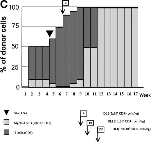 Fig. 4. Variations in donor myeloid and T-cell engraftment posttransplant and relationship with CSA reduction and DLI. (A) Patient 4: poor T-cell engraftment (maximum, 40%) followed by graft rejection despite CSA withdrawal and DLI. (B) Patient 10: rapid and complete donor T-cell engraftment by week 3; prolonged mixed myeloid chimerism (initially predominantly recipient) reaching 100% donor by week 17 after CSA withdrawal. (C) Patient 12: partial T-cell engraftment increasing to 100% donor after CSA withdrawal and DLI followed by complete donor myeloid engraftment by week 12.