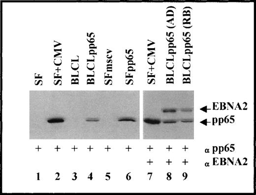 Fig. 1. Immunoblot analysis for the expression of CMV pp65 and EBV EBNA2. Lanes 1 through 6, probed against CMV pp65; lanes 7 through 9, probed against both EBV EBNA2 and CMV pp65.
