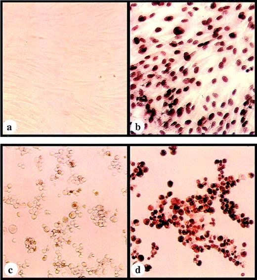 Fig. 2. Immunoperoxidase staining using a pp65-specific monoclonal antibody with (a) SF transduced with MSCV; (b) SF transduced with MSCVpp65; (c) BLCL transduced with MSCV; and (d) BLCL transduced with MSCVpp65.