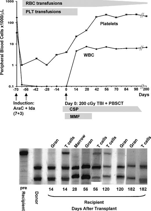 Fig. 1. Peripheral blood counts before and after HSCT (top) and microsatellite marker (region 33.6) analyses (bottom) on DNA from recipient and donor cells before transplant (lanes 1 and 2) and recipient cells after transplant (lanes 3 through 11).