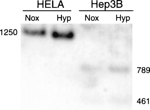 Fig. 2. Southern blot analysis of methylation in Hep3B and HeLa cells. / Genomic DNA from Hep3B and HeLa cells was digested with Xba1 and Eag1, fractionated by size, transferred to a nylon membrane, and hybridized to the full-length Xba1 fragment of the erythropoietin gene. The Xba1 fragment is 1250 bp long, and the combined Xba1/Eag1 fragments measure 461 and 789 bp. Nox, normoxia; Hyp, hypoxia for 8 hours.