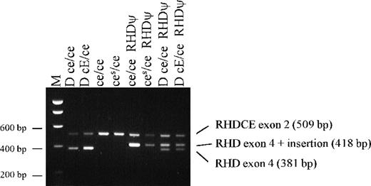 Fig. 2. Agarose gel showing results of PCR screening test for the 37 bp RHD exon 4 insert with samples from black South Africans.