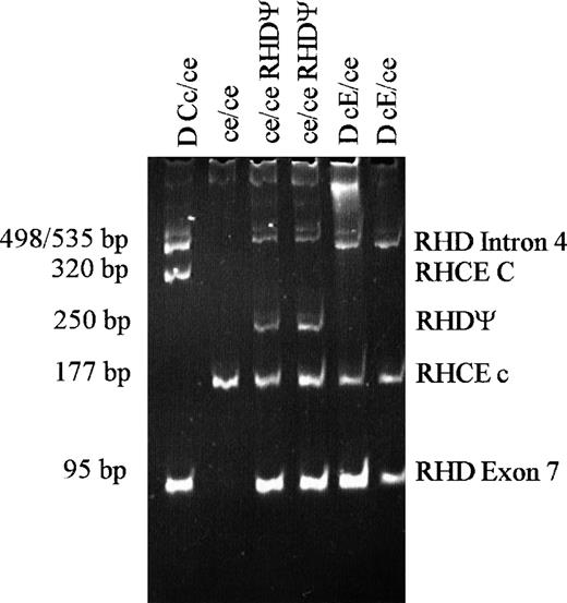 Fig. 3. Polyacrylamide gel showing results with multiplex PCR method for predicting D and C/c phenotype and for detecting the presence of RHDψ.