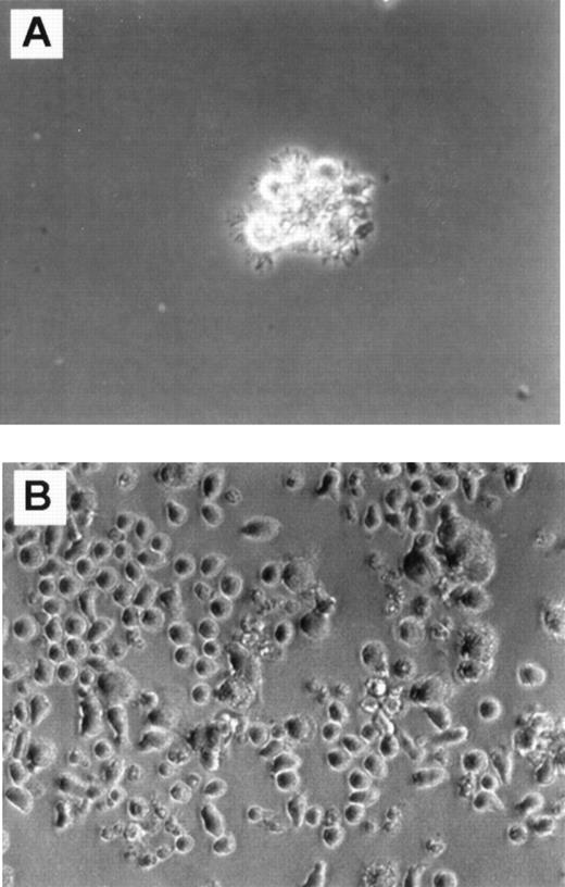 Fig. 1. Cultures in FKGm17. / Phase contrast photomicrograph (20 × ) shows cultures of CD34+ Lin− CD10+ cells (A) and CD34+ Lin− CD10−cells (B) in FKGm17 at day 11.