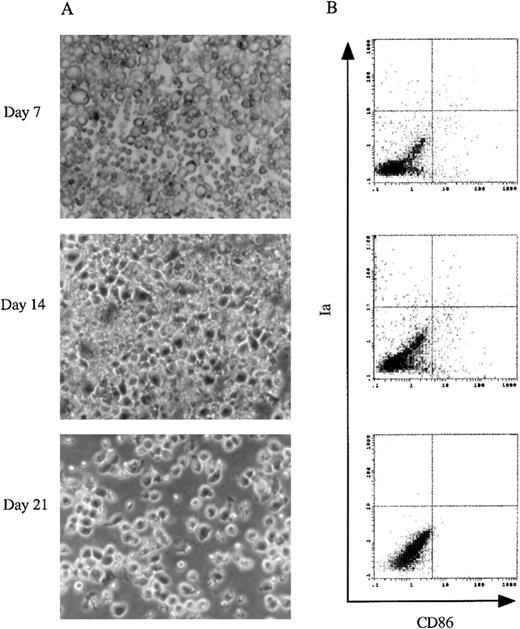 Fig. 2. The culture of murine 13 dpc FL-derived Lin−c-kit+ HPCs. / (A) Using a phase contrast microscope, morphologic analyses were performed on cultured murine 13 dpc FL-derived Lin−c-kit+ HPCs stimulated with GM-CSF + SCF + Flt3L + mTNFα at day 7, 14, and 21. Original magnifications: × 200. (B) 2-color immunofluorescence analysis was performed on the cultured cells at the indicated time points. The cells were sequentially stained with biotinylated CD86 MoAb and PE-labeled Ia MoAb. CD86 was revealed by FITC-streptavidin. The quads were set up on the isotype-matched control dot plot. These results are representative of 3 independent experiments.