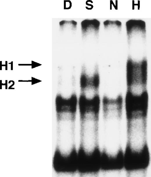 Fig. 6. EMSA with nuclear extracts from Hep3B cells. / Nuclear extracts (5 μg) from Hep3B cells, treated by 0.1% DMSO or 0.5 mmol/L SNAP (8 hours) or under normoxic or hypoxic conditions (12 hours), were incubated with WT HIF probe for 30 minutes at room temperature. SNAP-induced or hypoxia-induced complexes (H1 and H2) are indicated. D = DMSO, S = SNAP, N = normoxia, and H = hypoxia.