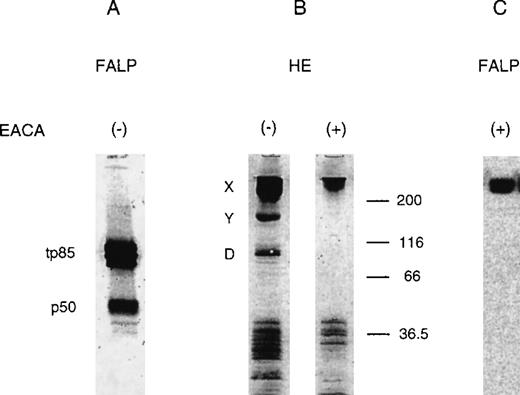 Fig. 2. Western blot of FALP with antifibrinogen antibody. / (A) FALP purified from normal human plasma was run on SDS-PAGE in nonreducing conditions and subjected to Western blot analysis with polyclonal antifibrinogen antibody (goat antifibrinogen IgG, Incstar). Bands defined previously as tp85 and p50 were stained. (B) HiPAC-Aldehyde column chromatography, the first step purification of FALP, was performed in the presence (right panel) and absence (left panel) of 150 mmol/L EACA. Eluates from these preparations (HE) were run on SDS-PAGE under nonreducing conditions and analyzed by Western blot analysis with goat antifibrinogen IgG. Fragments X, Y, and D are marked based on the molecular weight of the bands. (C) FALP prepared in the presence of EACA during HiPAC-Aldehyde (150 mmol/L) and Mono Q (50 mmol/L) column chromatography, were subjected to Western blot analysis as above with goat antifibrinogen IgG. Presence of LBP and FHRP-1 in FALP was confirmed by ELISA and Western blot analysis, respectively. Molecular weight standards are shown in kilodaltons.