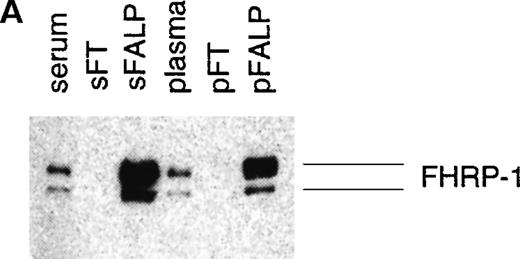 Fig. 4. Serum-derived FALP bears less fibrinogen than plasma-derived FALP but an equal amount of FHRP. / FALP was prepared from serum or plasma from the same donor. Samples derived from an equal amount of serum or plasma (∼30 mL) were diluted equivalently. Western blot analyses were performed with the starting serum or plasma, the flow-through of the first column chromatographic step (sFT and pFT), and the final FALP preparations (sFALP and pFALP). Anti-FHRP was used for the blot shown in panel A, and antifibrinogen was used for the blot shown in panel B. Molecular weight standards are shown in kilodaltons. Bands seen on FALP lanes of antifibrinogen blot (B) correspond to the size of fragment X (X). For this preparation, EACA was used only for the first column chromatography but not for the subsequent chromatographic steps. Therefore, the size of the fibrinogen fragment is bigger than that of the FALP prepared in the absence of EACA shown in Figure 2. The blot was overexposed to visualize the fibrinogen band in sFALP lane.