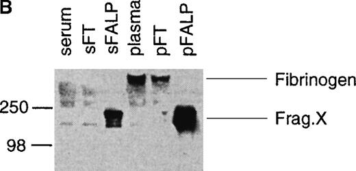 Fig. 4. Serum-derived FALP bears less fibrinogen than plasma-derived FALP but an equal amount of FHRP. / FALP was prepared from serum or plasma from the same donor. Samples derived from an equal amount of serum or plasma (∼30 mL) were diluted equivalently. Western blot analyses were performed with the starting serum or plasma, the flow-through of the first column chromatographic step (sFT and pFT), and the final FALP preparations (sFALP and pFALP). Anti-FHRP was used for the blot shown in panel A, and antifibrinogen was used for the blot shown in panel B. Molecular weight standards are shown in kilodaltons. Bands seen on FALP lanes of antifibrinogen blot (B) correspond to the size of fragment X (X). For this preparation, EACA was used only for the first column chromatography but not for the subsequent chromatographic steps. Therefore, the size of the fibrinogen fragment is bigger than that of the FALP prepared in the absence of EACA shown in Figure 2. The blot was overexposed to visualize the fibrinogen band in sFALP lane.